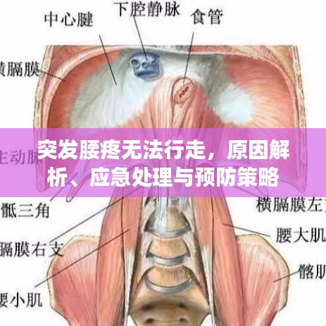 突发腰疼无法行走，原因解析、应急处理与预防策略