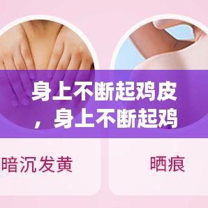 身上不断起鸡皮，身上不断起鸡皮疙瘩痒 