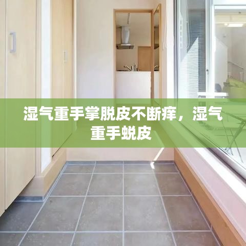 湿气重手掌脱皮不断痒，湿气重手蜕皮 