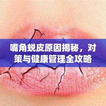 嘴角蜕皮原因揭秘，对策与健康管理全攻略