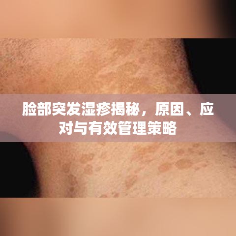 脸部突发湿疹揭秘，原因、应对与有效管理策略