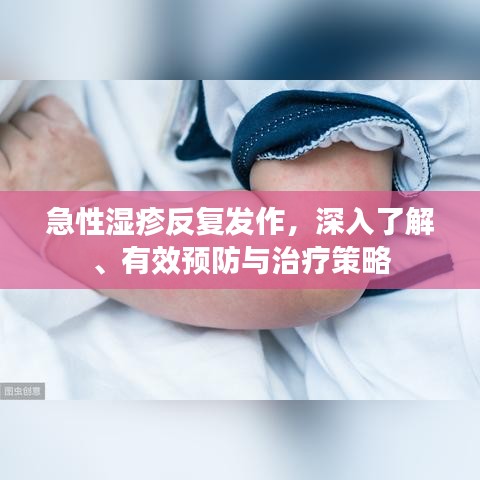 急性湿疹反复发作，深入了解、有效预防与治疗策略