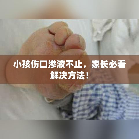 小孩伤口渗液不止，家长必看解决方法！