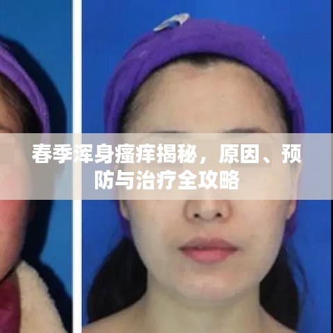 春季浑身瘙痒揭秘，原因、预防与治疗全攻略